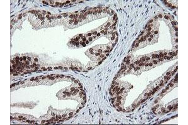 TRMT2A antibody