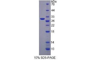 SDS-PAGE analysis of Human MPP3 Protein. (MPP3 Protein)