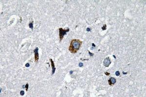 Immunohistochemistry (IHC) analyzes of ACE1 antibody in paraffin-embedded human brain tissue. (Angiotensin I Converting Enzyme 1 antibody)