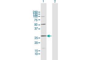 AKIP1 antibody  (AA 1-210)