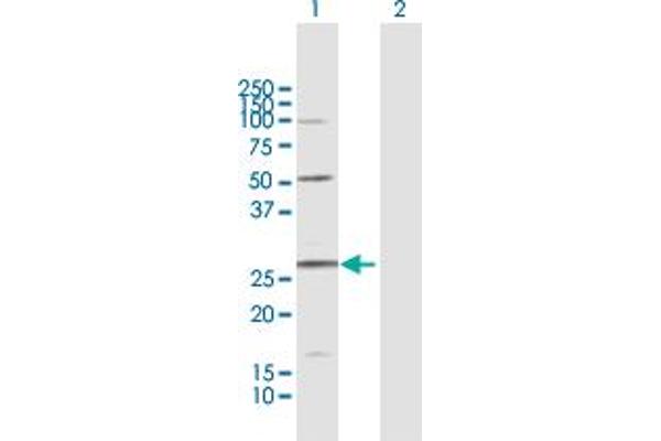 AKIP1 antibody  (AA 1-210)