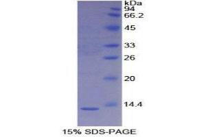 SDS-PAGE (SDS) image for S100 Calcium Binding Protein A4 (S100A4) (AA 1-101) protein (His tag) (ABIN1080724)