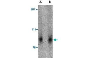Western blot analysis of SLITRK2 in mouse brain tissue lysate with SLITRK2 polyclonal antibody  at (A) 1 and (B) 2 ug/mL . (SLITRK2 antibody  (Internal Region))