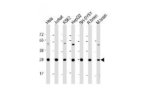 All lanes : Anti-HSD17B10 Antibody (Center) at 1:2000 dilution Lane 1: Hela whole cell lysate Lane 2: Jurkat whole cell lysate Lane 3: K562 whole cell lysate Lane 4: HepG2 whole cell lysate Lane 5: SH-SY5Y whole cell lysate Lane 6: rat brain lysate Lane 7: mouse brain lysate Lysates/proteins at 20 μg per lane. (HSD17B10 antibody  (AA 140-172))
