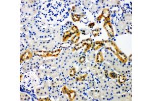 IHC-P: NOX4 antibody testing of rat kidney tissue (NADPH Oxidase 4 antibody  (C-Term))