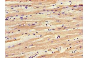IHC image of ABIN7143542 diluted at 1:1200 and staining in paraffin-embedded human heart tissue performed on a Leica BondTM system. (SLC25A6 antibody  (AA 144-175))