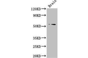 Western Blot Positive WB detected in: Mouse brain tissue All lanes: TRIM43 antibody at 3 μg/mL Secondary Goat polyclonal to rabbit IgG at 1/50000 dilution Predicted band size: 53 kDa Observed band size: 53 kDa (TRIM43 antibody  (AA 43-240))