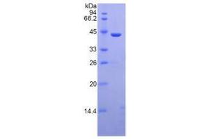 Image no. 2 for Mannose-Binding Lectin (Protein C) 2, Soluble (MBL2) (AA 130-248) (Active) protein (His tag,GST tag) (ABIN6239795) (MBL2 Protein (AA 130-248) (His tag,GST tag))