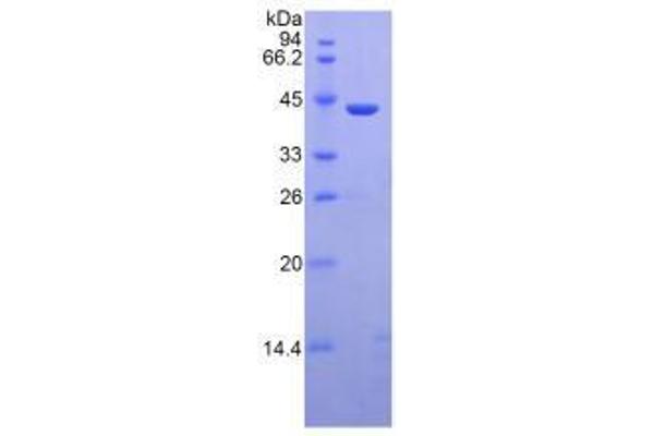 MBL2 Protein (AA 130-248) (His tag,GST tag)