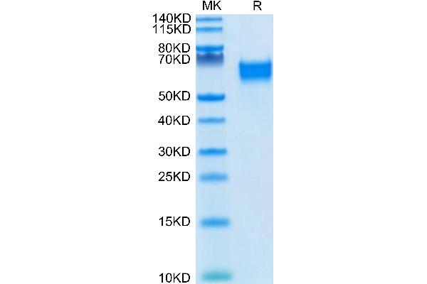 IL18R1 Protein (AA 19-329) (His-Avi Tag,Biotin)