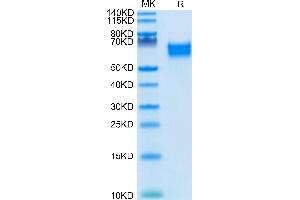 Biotinylated Human IL-18 R1/CD218a on Tris-Bis PAGE under reduced condition.