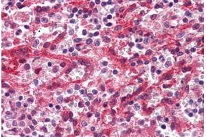 Human Spleen, Red Pulp (formalin-fixed, paraffin-embedded) stained with DARC antibody ABIN337034 at 2. (DARC antibody  (C-Term))