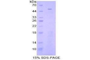 SDS-PAGE analysis of Mouse Fibrinogen beta Protein. (Fibrinogen beta Chain Protein (FGB))