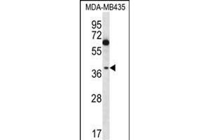 NFKBIL1 Antibody (C-term) (ABIN656729 and ABIN2845953) western blot analysis in MDA-M cell line lysates (35 μg/lane). (NFKBIL1 antibody  (C-Term))