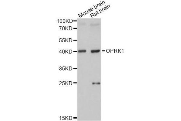 OPRK1 抗体  (C-Term)