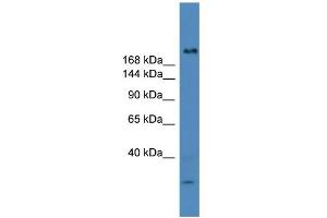 WB Suggested Anti-USP9Y Antibody Titration: 0. (USP9Y antibody  (C-Term))