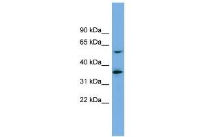 WB Suggested Anti-SLC7A7 Antibody Titration:  0.