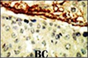 Immunohistochemistry (Paraffin-embedded Sections) (IHC (p)) image for anti-EPH Receptor A4 (EPHA4) (AA 40-70), (N-Term) antibody (ABIN391889)