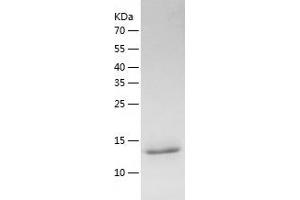 Western Blotting (WB) image for Lacritin (LACRT) (AA 20-138) protein (His tag) (ABIN7288746) (Lacritin Protein (LACRT) (AA 20-138) (His tag))