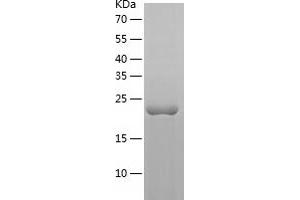 Western Blotting (WB) image for Ras Homolog Gene Family, Member B (RHOB) (AA 1-193) protein (His tag) (ABIN7286717) (RHOB Protein (AA 1-193) (His tag))