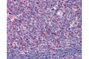 Anti-IMP3 antibody IHC of human tonsil. (IMP3 antibody  (C-Term))