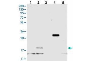 Western blot analysis of Lane 1: RT-4, Lane 2: U-251 MG, Lane 3: Human Plasma, Lane 4: Liver, Lane 5: Tonsil with C21orf57 polyclonal antibody . (ybeY antibody)