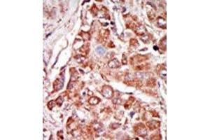 Image no. 2 for anti-Eukaryotic Translation Initiation Factor 2-alpha Kinase 2 (EIF2AK2) (N-Term) antibody (ABIN360663) (EIF2AK2 antibody  (N-Term))