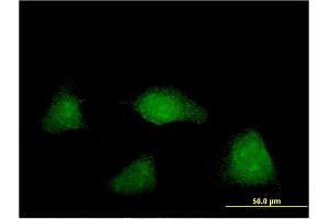 Immunofluorescence of monoclonal antibody to NUAK2 on HeLa cell.