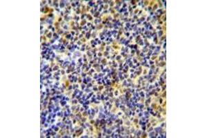 Immunohistochemistry analysis in formalin fixed and paraffin embedded human tonsil tissue using IKZF1/IKAROS Antibody (C-term), followed by peroxidase conjugation of the secondary antibody and DAB staining. (IKZF1 antibody  (C-Term))