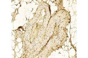 Immunohistochemical analysis of paraffin-embedded Human Skeletal muscle section using Pink1 (ABIN6242381 and ABIN6577241). (Hexokinase 2 antibody  (AA 1-170))