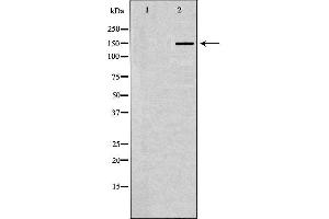 Western blot analysis of Jurkat whole cell lysates, using CASP7 Antibody. (Caspase 7 antibody  (N-Term))