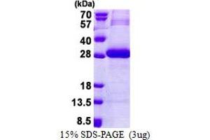 SDS-PAGE (SDS) image for Protease, serine, 3 (PRSS3) (AA 81-304) protein (His tag) (ABIN5853148)