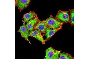 Immunocytochemistry (ICC) image for anti-RAB6B, Member RAS Oncogene Family (RAB6B) (AA 95-208) antibody (ABIN5542692)