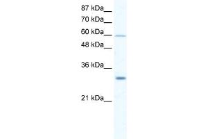DDX31 antibody used at 2.