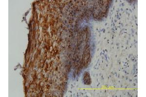 Immunoperoxidase of monoclonal antibody to SFN on formalin-fixed paraffin-embedded human uterine cervix tissue. (14-3-3 sigma/SFN antibody  (AA 1-248))