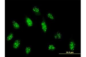 Immunofluorescence of purified MaxPab antibody to CENPB on HeLa cell.