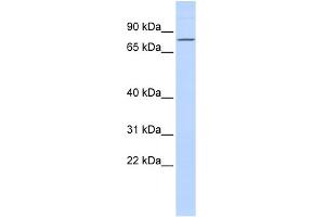 WB Suggested Anti-ZNF354A Antibody Titration:  0. (ZNF354A antibody  (Middle Region))