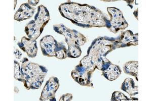 IHC analysis of MCM6 using anti-MCM6 antibody (ABIN7600038). (MCM6 antibody  (AA 14-821))