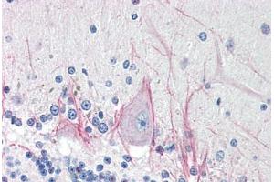 Human Brain, Cerebellum (formalin-fixed, paraffin-embedded) stained with DNASE2 antibody ABIN214485 at 5 ug/ml followed by biotinylated goat anti-rabbit IgG secondary antibody ABIN481713, alkaline phosphatase-streptavidin and chromogen. (DNASE2 antibody  (AA 347-360))