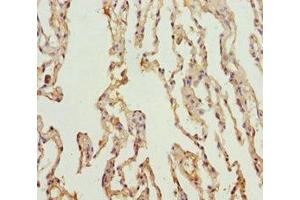 Immunohistochemistry of paraffin-embedded human lung tissue using ABIN7164013 at dilution of 1:100 (KCNS3 antibody  (AA 1-180))