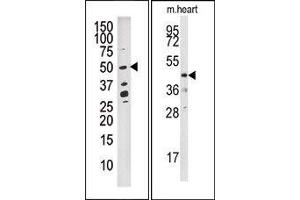 Image no. 1 for anti-Dual Specificity Phosphatase 10 (DUSP10) (N-Term) antibody (ABIN360788)
