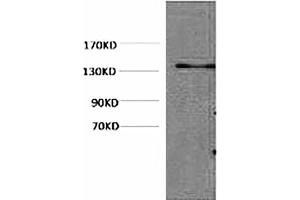 Western blot analysis of Hela, diluted at 1:1000. (HSV Tag antibody)