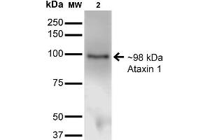Western Blot analysis of Monkey COS-1 cells transfected with Ataxin- 1 showing detection of ~85 kDa Ataxin 1 protein using Mouse Anti-Ataxin 1 Monoclonal Antibody, Clone S65-37 . (Ataxin 1 antibody  (AA 746-761) (Biotin))