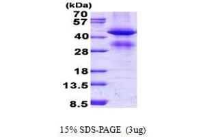 Glycine C-Acetyltransferase (GCAT) (AA 22-419) protein (His tag)