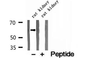 Western blot analysis of extracts of rat kidney tissue, using CKAP4 antibody. (CKAP4 antibody  (C-Term))