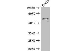 Western Blot Positive WB detected in: Mouse brain tissue All lanes: SLC6A3 antibody at 3 μg/mL Secondary Goat polyclonal to rabbit IgG at 1/50000 dilution Predicted band size: 69 kDa Observed band size: 69 kDa (SLC6A3 antibody  (AA 161-237))