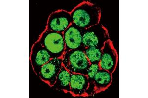 Confocal immunofluorescent analysis of Phospho-CDX2- Antibody (ABIN650838 and ABIN2839803) with WiDr cell followed by Alexa Fluor 488-conjugated goat anti-rabbit lgG (green).