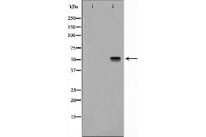 Western blot analysis of NK1R expression in Mouse lung lysate The lane on the left is treated with the antigen-specific peptide. (TACR1 antibody  (Internal Region))