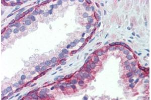 Human Prostate (formalin-fixed, paraffin-embedded) stained with UBE2L3 antibody ABIN462238 followed by biotinylated goat anti-rabbit IgG secondary antibody ABIN481713, alkaline phosphatase-streptavidin and chromogen. (UBE2L3 antibody  (C-Term))