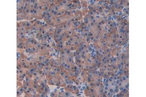 Used in DAB staining on fromalin fixed paraffin- embedded Kidney tissue (pPLA2 antibody  (AA 16-148))